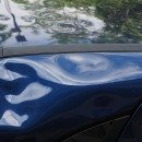 Dents No More!